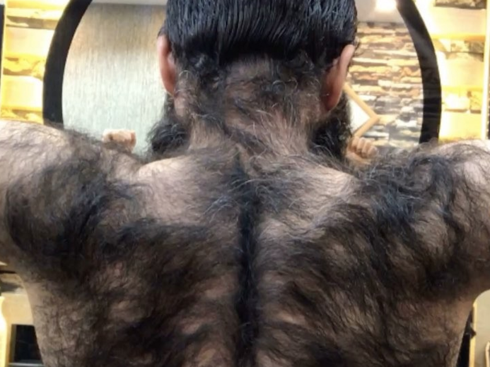 you have such hairy back
